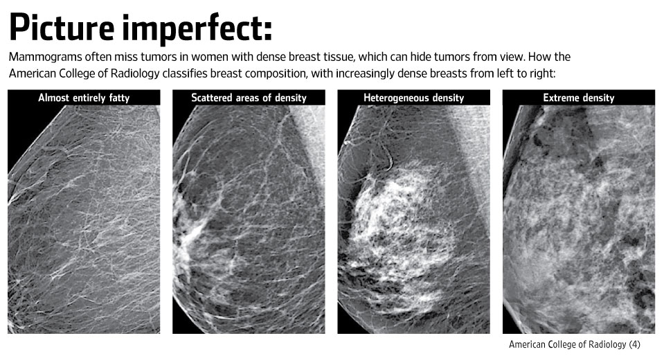 dense%20breast.jpg