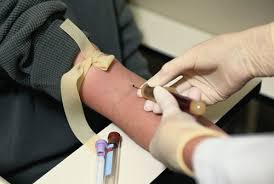 blood draw