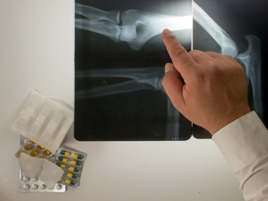 doctor-and-x-ray